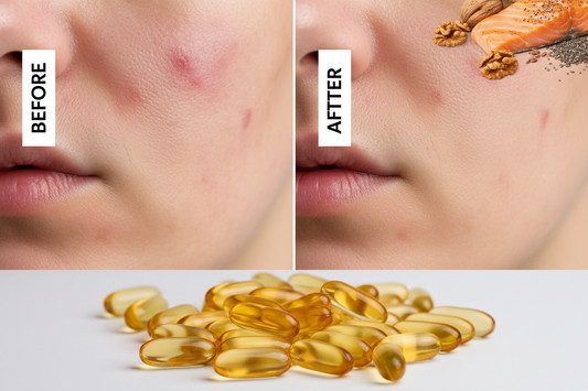 Omega-3 for Skin: Before and After Results